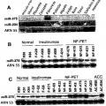 Ilustración 7 de Anomalías de la expresión de microARN en tumores pancreáticos endocrinos y acinares