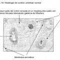 Ilustración 12 de Aislamiento de células madre/progenitoras de membrana amniótica del cordón umbilical
