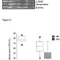 Ilustración 7 de Bloqueo de la señalización de CCL18 a través de CCR6 como una opción terapéutica en enfermedades fibróticas y cáncer