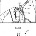 Ilustración 2 de Mecanismo de rueda dentada de aplicador de grapas quirúrgicas.