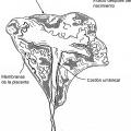 Ilustración 2 de Método para recolectar células troncales placentarias.