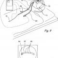 Ilustración 8 de Sistema de realización de procedimientos dentro del oído, nariz, garganta y senos paranasales