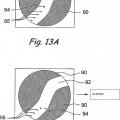 Ilustración 10 de Sistema de realización de procedimientos dentro del oído, nariz, garganta y senos paranasales