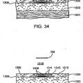 Ilustración 2 de Sistemas para crear un efecto sobre un tejido especificado usando energía de microondas.