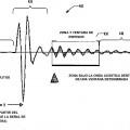 Ilustración 3 de Aparato y método para medir la impedancia acústica de fluidos de pozo