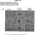 Ilustración 10 de Uso de compuestos péptidos de TPO y composiciones farmacéuticas en el tratamiento de la anemia