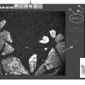 Ilustración 2 de Sistema y procedimiento para tomografía de coherencia óptica