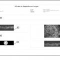 Ilustración 10 de Sistema y procedimiento para tomografía de coherencia óptica