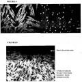 Ilustración 1 de Mejoras relativas a la descelularización de matrices de tejido para el implante de vejiga