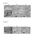 Ilustración 9 de Mejoras relativas a la descelularización de matrices de tejido para el implante de vejiga
