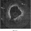 Ilustración 2 de Métodos cuantitativos para obtener características de un tejido a partir de imágenes de tomografía por coherencia óptica.