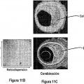 Ilustración 5 de Métodos cuantitativos para obtener características de un tejido a partir de imágenes de tomografía por coherencia óptica
