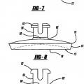 Ilustración 3 de Conjunto de tornillo y varilla para fijación de la columna vertebral.