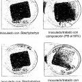 Ilustración 5 de Composiciones básicas que comprenden un alcanol y una sal de ácido graso o un glicérido de ácido graso para esterilizar un material