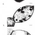 Ilustración 3 de Vacunas y pruebas de diagnóstico de Streptococcus suis.