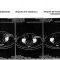 Ilustración 11 de Medios y procedimientos para el tratamiento de enfermedades tumorales