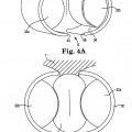 Ilustración 4 de Sistema de esfínter urinario artificial que tiene un manguito con un balón o globo fijado a un bastidor.