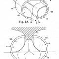 Ilustración 5 de Sistema de esfínter urinario artificial que tiene un manguito con un balón o globo fijado a un bastidor