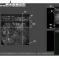 Ilustración 9 de Sistema y procedimiento para tomografía de coherencia óptica