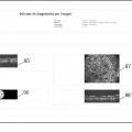 Ilustración 12 de Sistema y procedimiento para tomografía de coherencia óptica