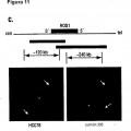 Ilustración 7 de ROS quinasa mutante y de translocación en el carcinoma pulmonar no microcítico humano