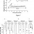 Ilustración 5 de Detección de estados hipocinéticos y/o hipercinéticos