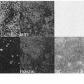 Ilustración 6 de Método para producir células progenitoras retinianas polarizadas a partir de células madre pluripotentes y su diferenciación para dar células del epitelio pigmentario retiniano