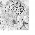 Ilustración 8 de Método para producir células progenitoras retinianas polarizadas a partir de células madre pluripotentes y su diferenciación para dar células del epitelio pigmentario retiniano