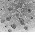 Ilustración 9 de Método para producir células progenitoras retinianas polarizadas a partir de células madre pluripotentes y su diferenciación para dar células del epitelio pigmentario retiniano
