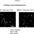 Ilustración 6 de Tratamiento de metástasis cerebrales con inhibidores de los receptores de endotelina en combinación con un agente quimioterapéutico citotóxico