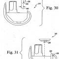 Ilustración 12 de Sistema de prótesis de rodilla modular