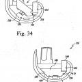 Ilustración 14 de Sistema de prótesis de rodilla modular