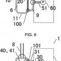 Ilustración 3 de Sensor de presión para circuito de circulación extracorporal