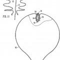 Ilustración 6 de Un dispositivo de iluminación para un globo.