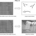 Ilustración 8 de Aparato y procedimiento para la eliminación de defectos virtuales de placas sensibles a los rayos X