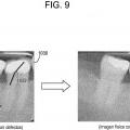 Ilustración 9 de Aparato y procedimiento para la eliminación de defectos virtuales de placas sensibles a los rayos X