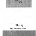 Ilustración 5 de Compuestos de éter de fosfolípido fluorescentes, composiciones y procedimientos de uso