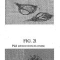 Ilustración 6 de Compuestos de éter de fosfolípido fluorescentes, composiciones y procedimientos de uso