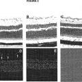 Ilustración 2 de Composiciones para usar en el tratamiento de glaucoma o hipertensión ocular.