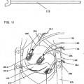 Ilustración 7 de Instrumento de tratamiento para la cirugía de desviación aortocoronaria