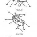 Ilustración 8 de Implante vertebral con dispositivo de anclaje