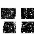 Ilustración 8 de Anticuerpos monoclonales contra la claudina-18 para el tratamiento del cáncer