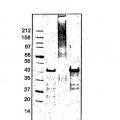 Ilustración 12 de FKBP-L y usos del mismo como inhibidor de la angiogénesis