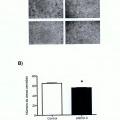 Ilustración 2 de Uso de anticuerpos frente a la enzima SOD-3 para la inhibición del proceso de la angiogénesis y aplicaciones de dichos anticuerpos y de dicha enzima SOD-3