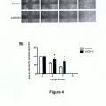 Ilustración 4 de Uso de anticuerpos frente a la enzima SOD-3 para la inhibición del proceso de la angiogénesis y aplicaciones de dichos anticuerpos y de dicha enzima SOD-3