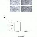 Ilustración 5 de Uso de anticuerpos frente a la enzima SOD-3 para la inhibición del proceso de la angiogénesis y aplicaciones de dichos anticuerpos y de dicha enzima SOD-3