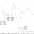Ilustración 2 de Producto intermedio de dimeglumina de fosaprepitant, fosaprepitant neutro y dimeglumina de fosaprepitant amorfa, y procesos para sus preparaciones