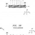 Ilustración 3 de Disposiciones de haces de tubos helicoidales para intercambiadores de calor.