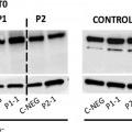 Ilustración 5 de ARN de interferencia para el tratamiento del Síndrome Linfoproliferativo Autoinmune de tipo la.