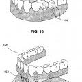 Ilustración 10 de Sistemas de retención dental